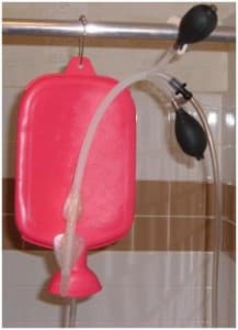 Bag-Enema Setup The bag was coloured pink.